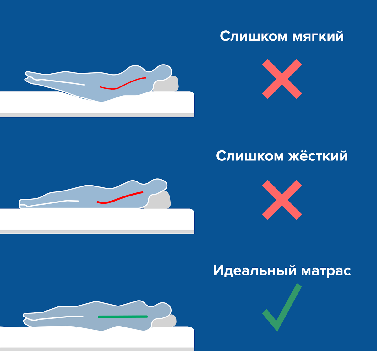 Какой матрас нужен после операции на позвоночнике