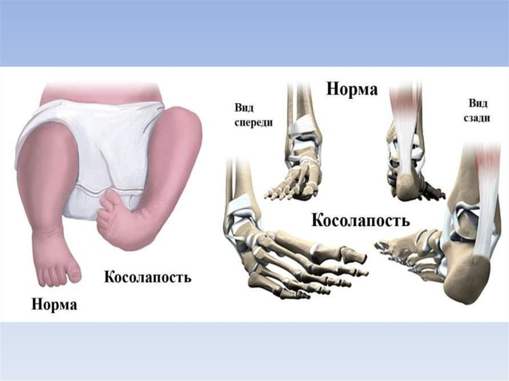 Кости кривошеев