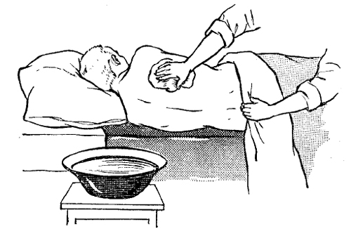 Укажите оптимальную температуру воды при организации туалета тела тяжелобольного