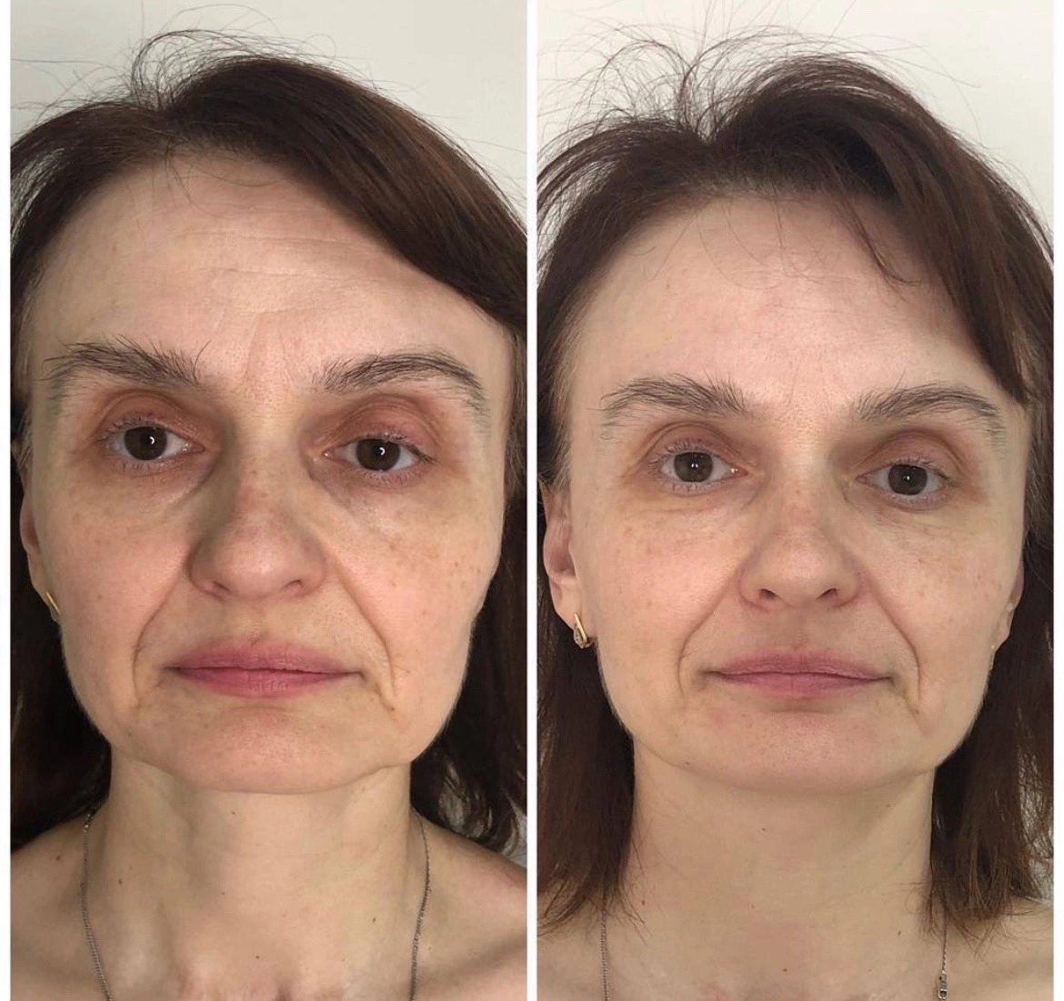 Спортивные ноги. Valentina grishko 2019. Мужчина и женщина с красивой фигурой. Стройная фигура. Валентина гришко бикини.