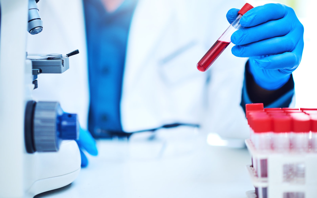  Болезнь Педжета (остеодистрофия) - хроническое заболевание костей скелета, при котором происходит усиление метаболизма костной ткани. Со временем кости могут стать хрупкими и деформироваться.-2