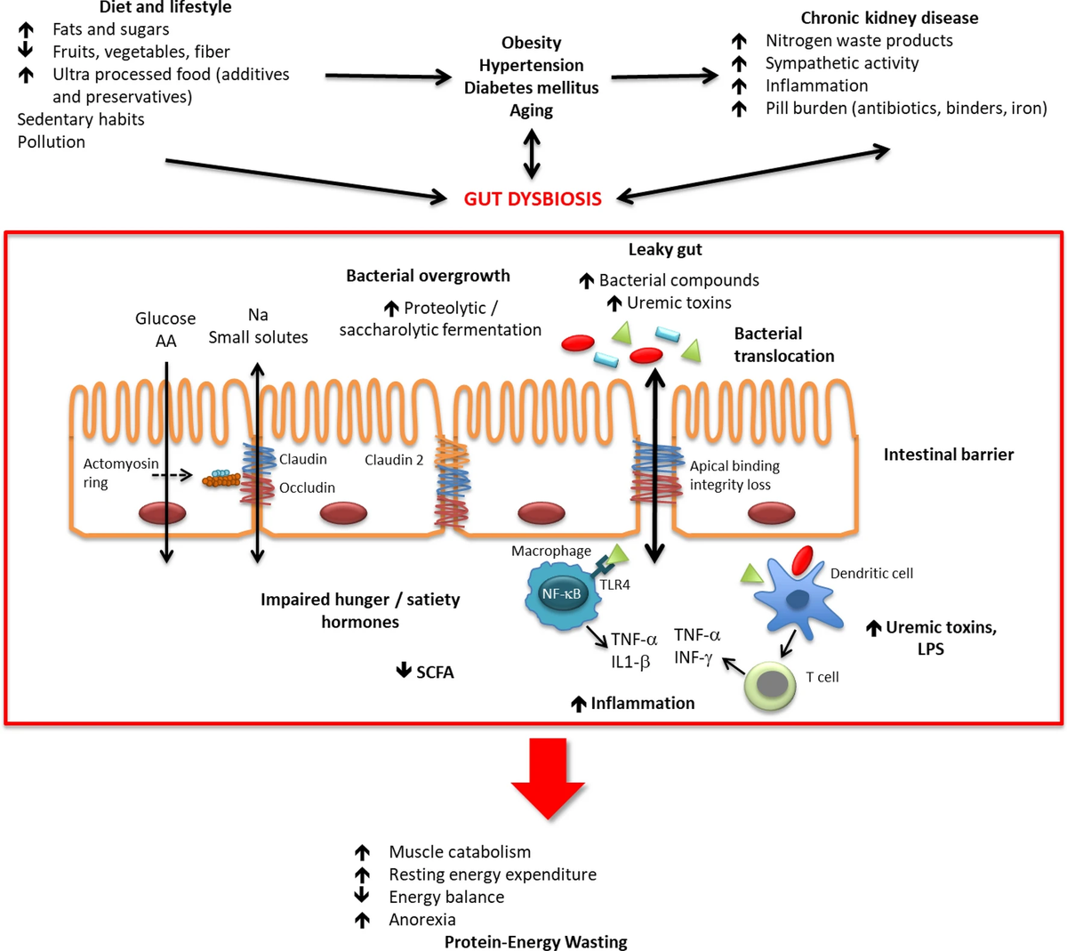 Источник: Martín-del-Campo, F., Avesani, C.M., Stenvinkel, P. et al. Gut microbiota disturbances and protein-energy wasting in chronic kidney disease: a narrative review. J Nephrol 36, 873–883 (2023). https://doi.org/10.1007/s40620-022-01560-1 Взаимодействия между факторами, способствующими дисбиозу кишечника и возникновением белково-энергетической недостаточности у пациентов с ХБП.