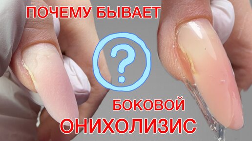 БОКОВОЙ ОНИХОЛИЗИС | КОРРЕКЦИЯ ГЕЛЕМ | ВЕРХНИЕ ФОРМЫ#алена_лаврентьева #nails #ногти #маникюр