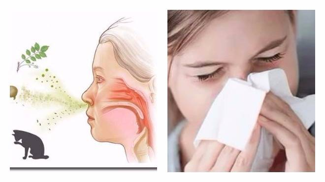 Что такое аллергия - причины, обострение, лечение аллергии | ЛДЦ Кутузовский