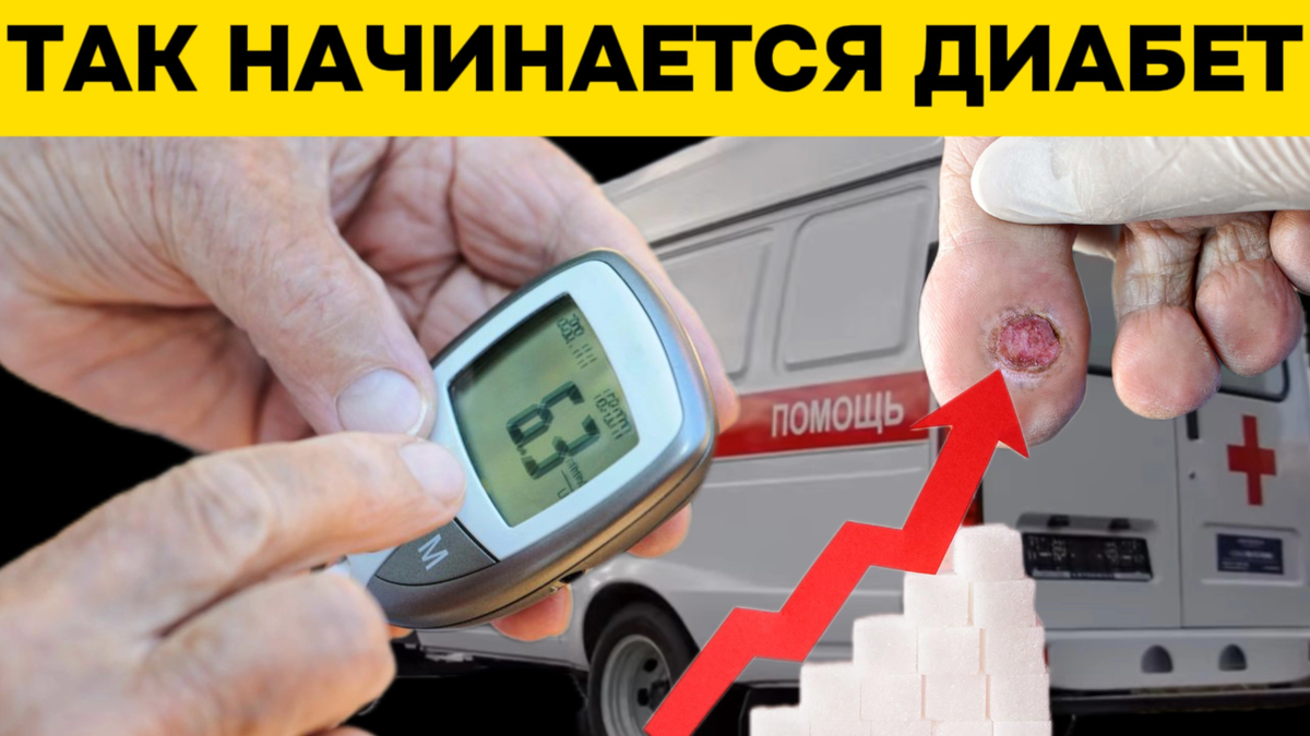 Диабет сахар 12