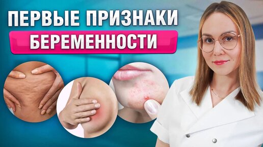 Как узнать о беременности ДО ЗАДЕРЖКИ? Ранние симптомы беременности