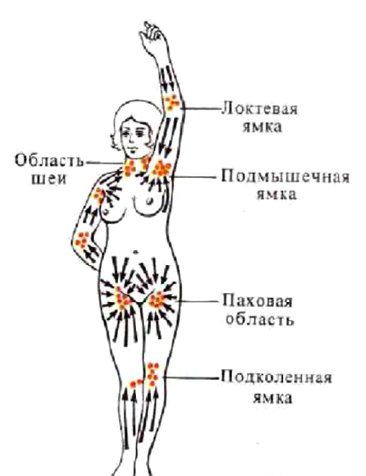 Лимфоузел после массажа. Схема расположения лимфоузлов на теле человека. Лимфоузлы человека схема. Где находятся лимфатические узлы у человека схема. Лимфоузлы на теле человека расположение у женщин схема.