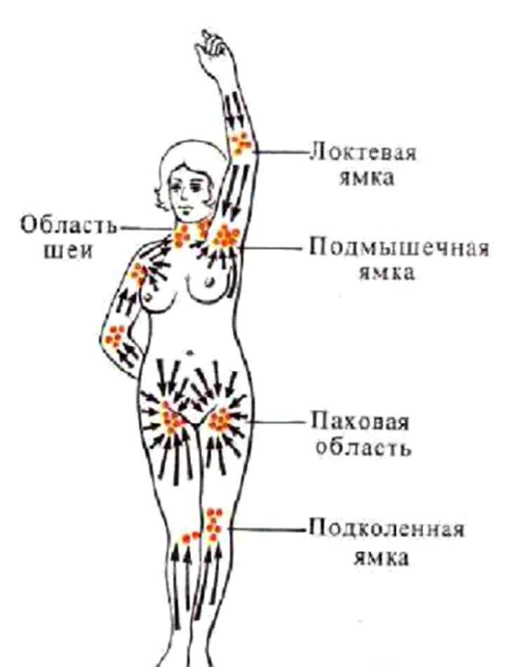 Лимфоузлы на ногах расположение у женщин схема
