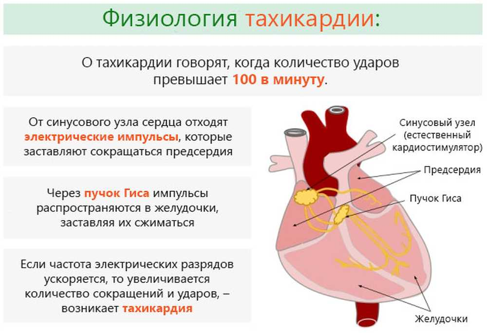 Сильное сердцебиение