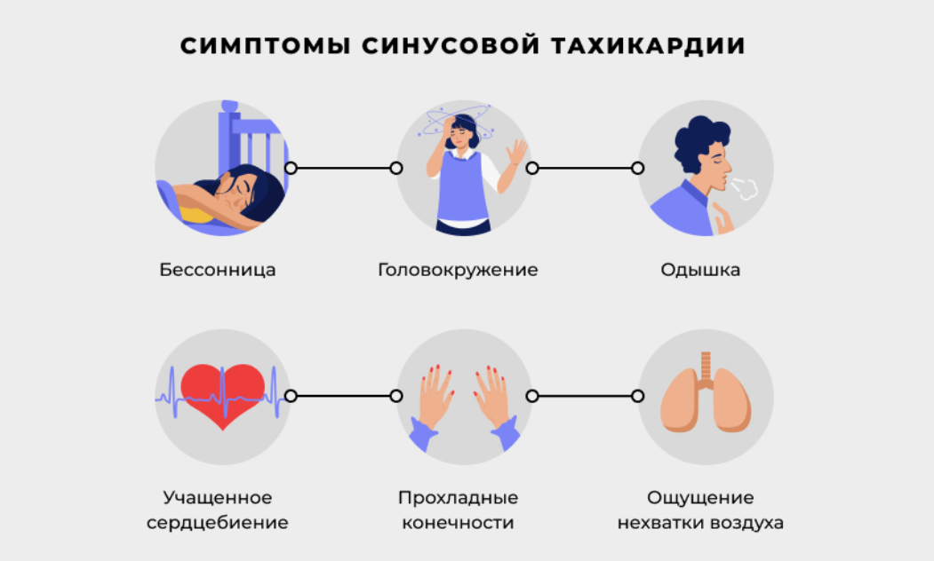 Тахикардия - что это, симптомы и причины возникновения