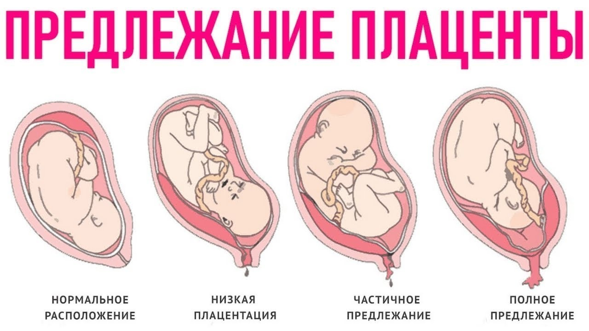 7 неуклюжих вопросов про секс во время беременности