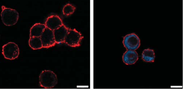 Фото взято из открытых источников. Красное окрашивание - мембраны клеток, синие - биополимер. 
