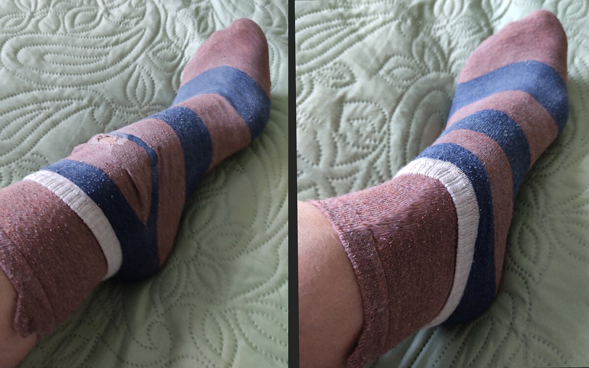 Про тапочки от Versace и дырявые носки | На природе, во саду и в ...