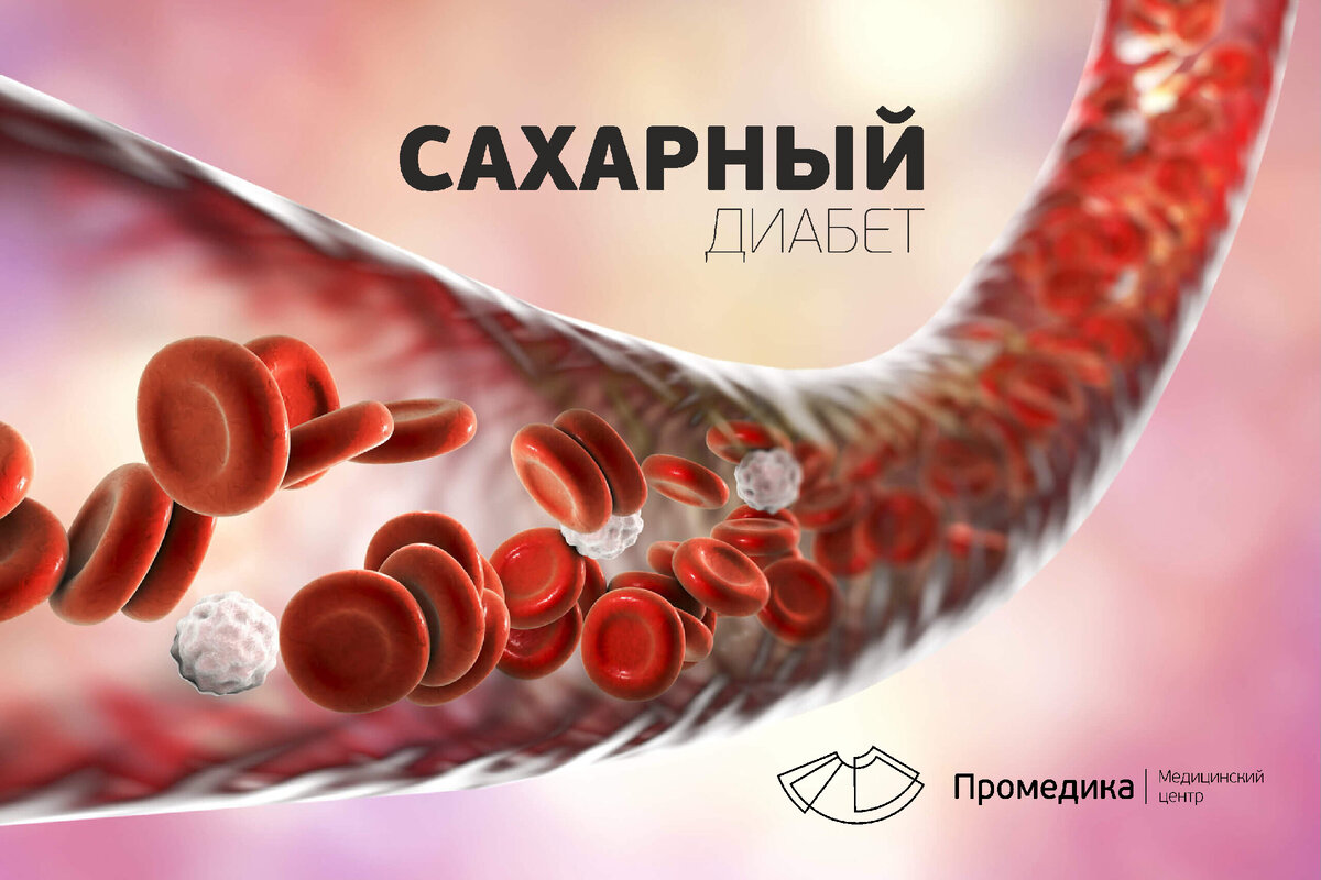 Сахарный диабет, симптомы, типы, лечение. | Медицинский центр 