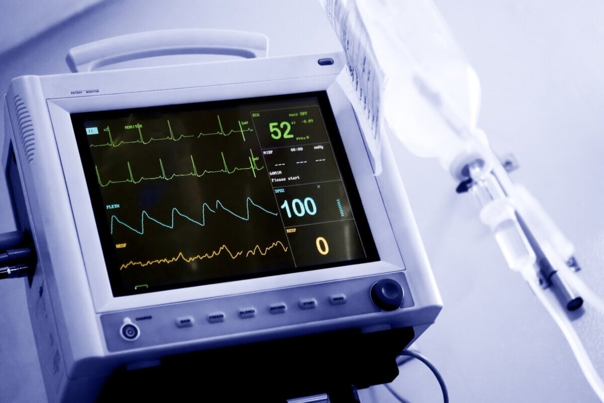 Давление во время операции. Ритм 100 аппарат ИВЛ. Монитор аппарата ИВЛ. Кардиомонитор и ЭКГ. Прибор жизнеобеспечения.