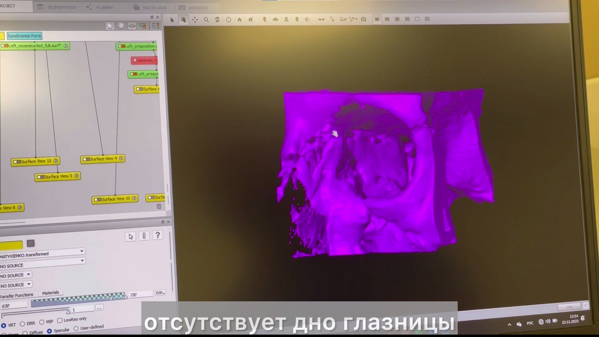 Перелом пястной кости мизинца. Как понять сломана ли. Как понять перелом или ушиб ноги. Растяжения и разрывы связок суставов. Как определить перелом запястья.