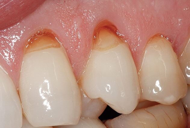 Фото: juniordentist.com