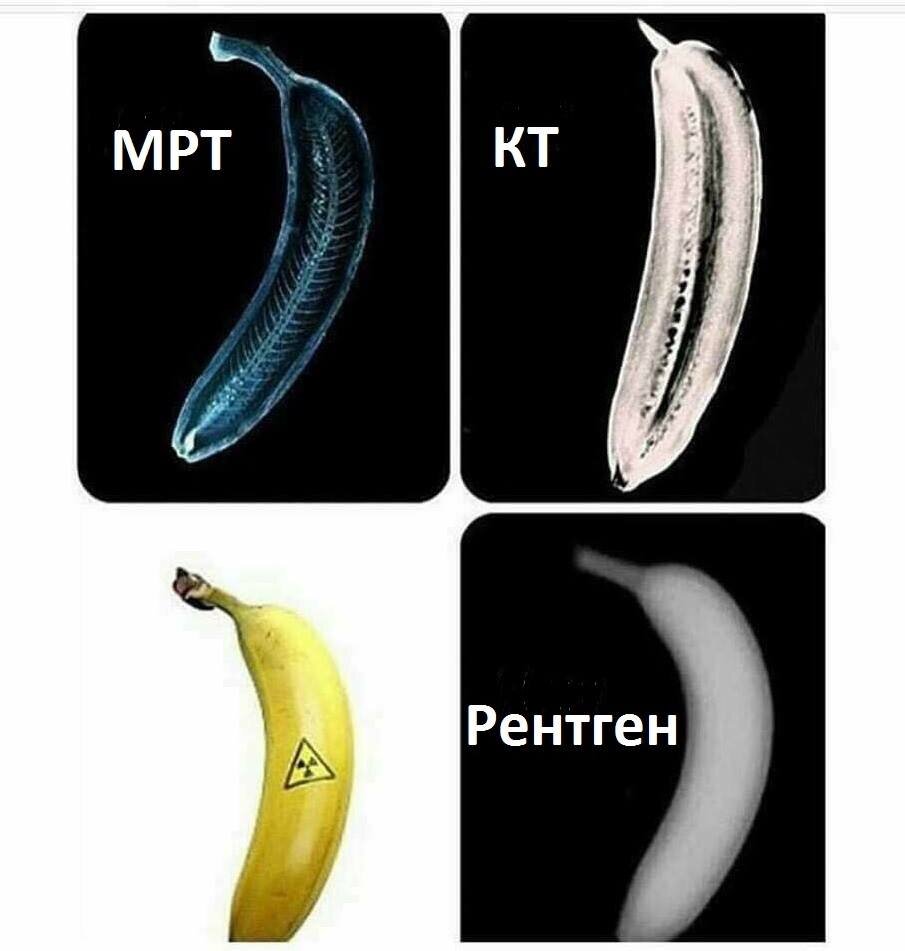 КТ и рентген