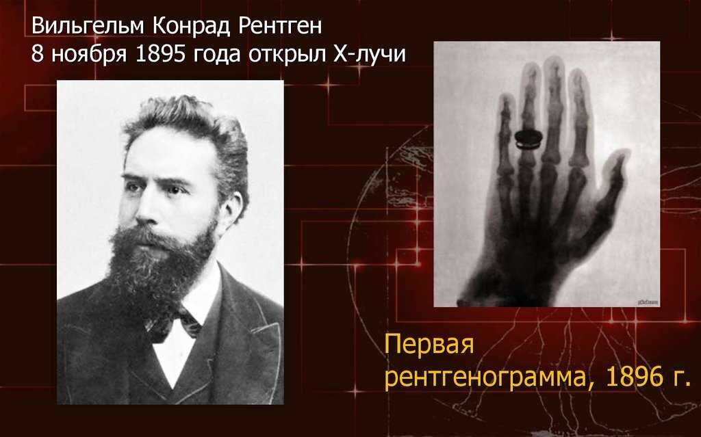 Вильгельм Конрад Рентген создал первый рентгеновский аппарат