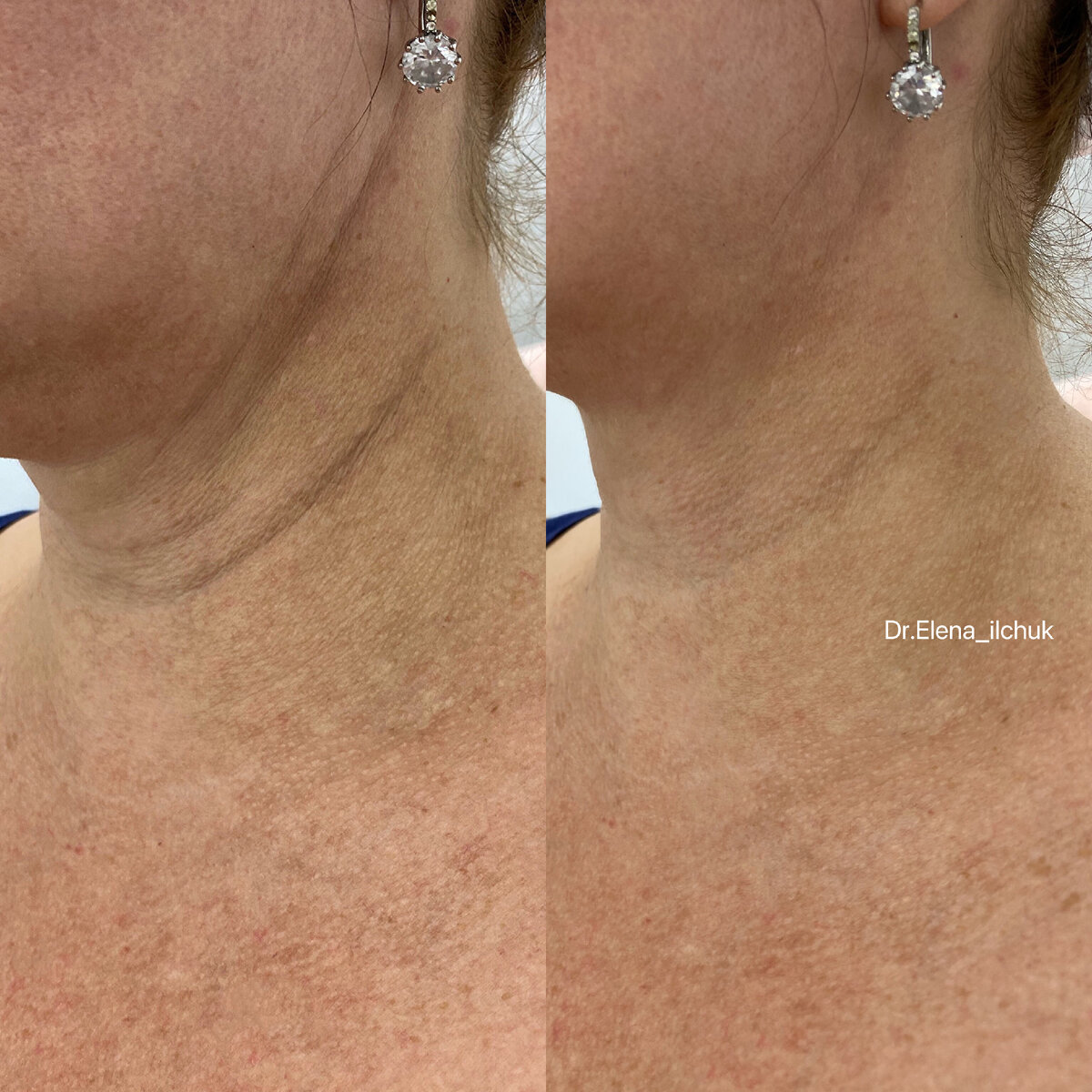 Работы врачей-косметологов клиники ELEVANS