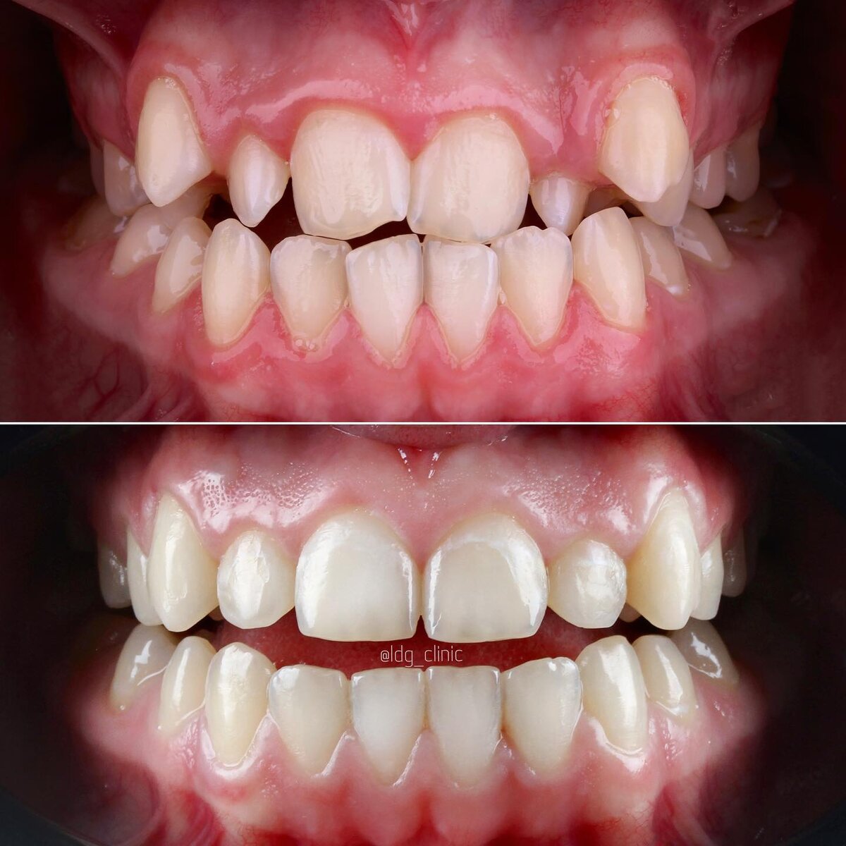 Работа докторов Light Dental Group 