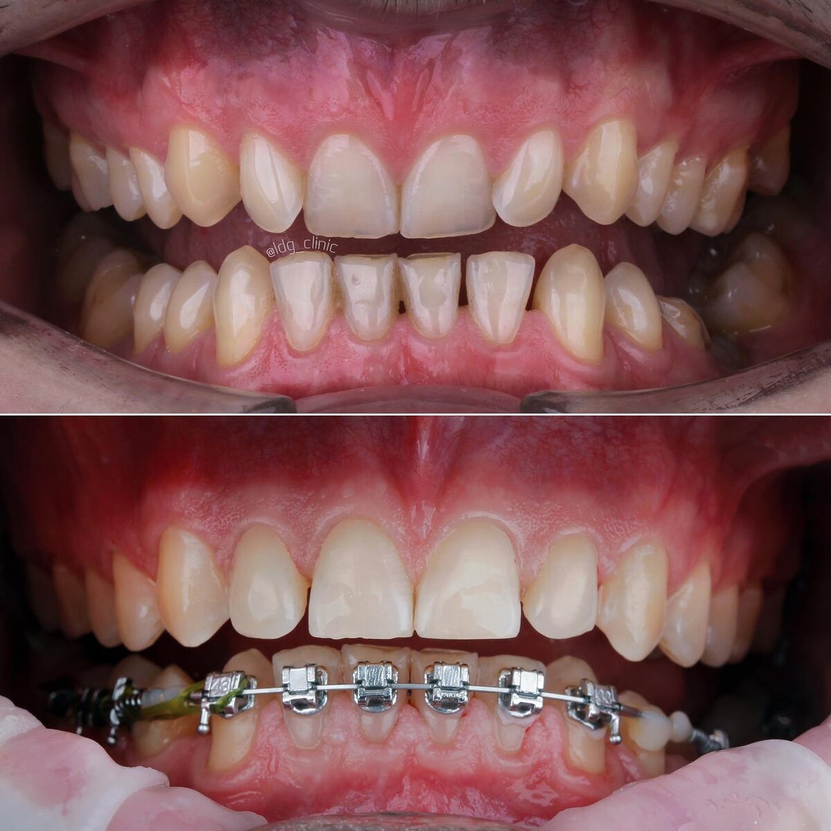 Работа докторов Light Dental Group 