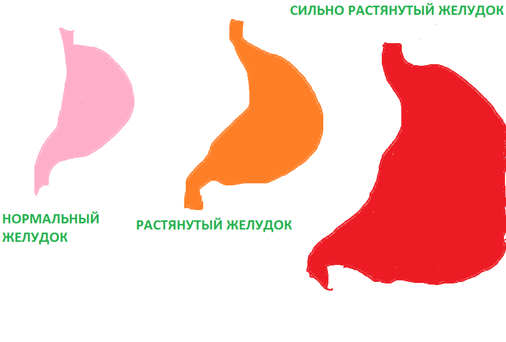 Насколько растягивается. Нормальный и растянутый желудок. Насколько может растянуться желудок.