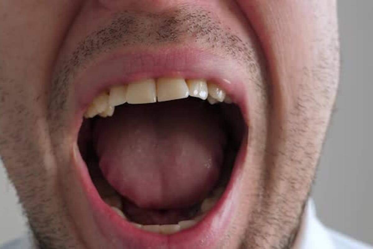 Аскарида основной хозяин и промежуточный хозяин. Микробиом кишечника. Паразитические организмы человека в кишечнике. Закупорка кишечника аскаридами. В кишечнике человека обитают.