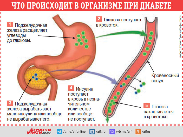 Сахарный диабет операция. Нейрохирургическая операционная. При сахарном диабете делают операции. Сахар диабет. Сахарный диабет шифр мкб.