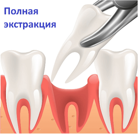 как вытащить рыбную кость из десны | Дзен