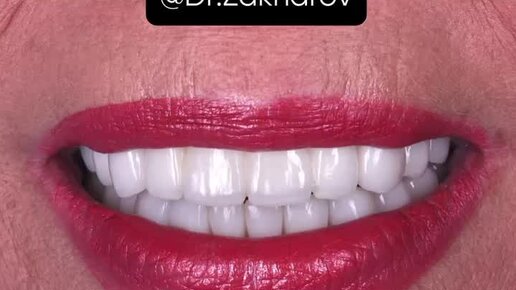 6. забыть уничтожать. все безнадежно. забыть уничтожать. божью любовь не разрушить чарами.