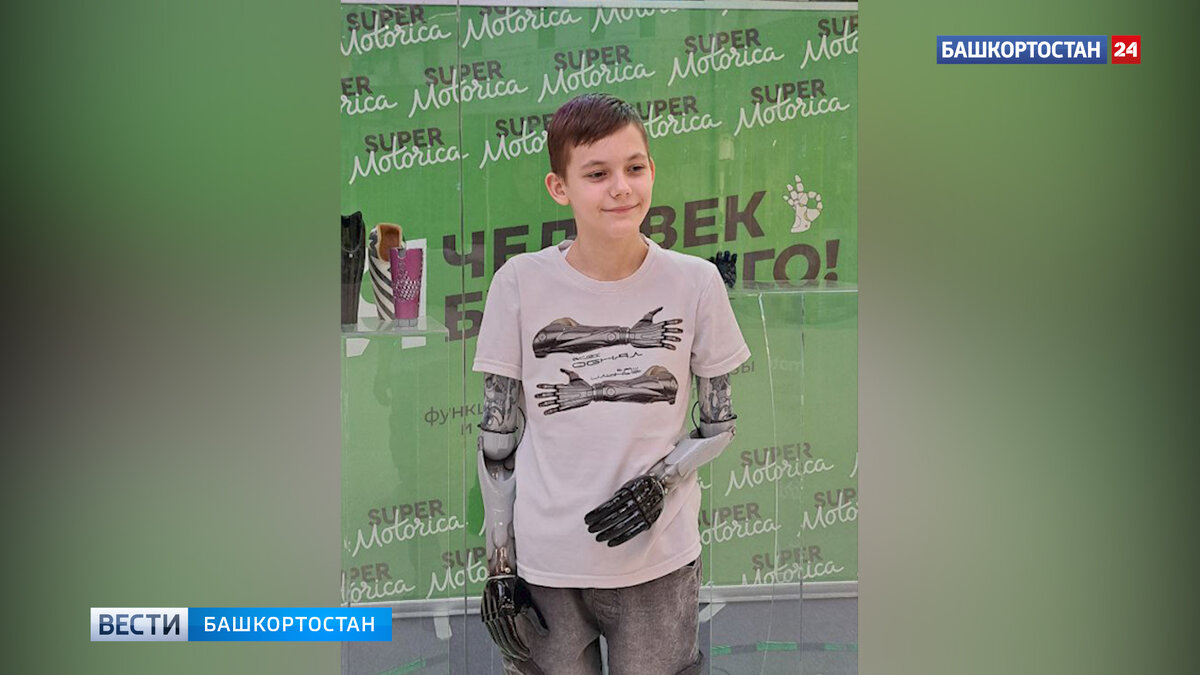    Потерявший конечности в 10-летнем возрасте Ильназ Давлетов из Башкирии получил новые киберруки