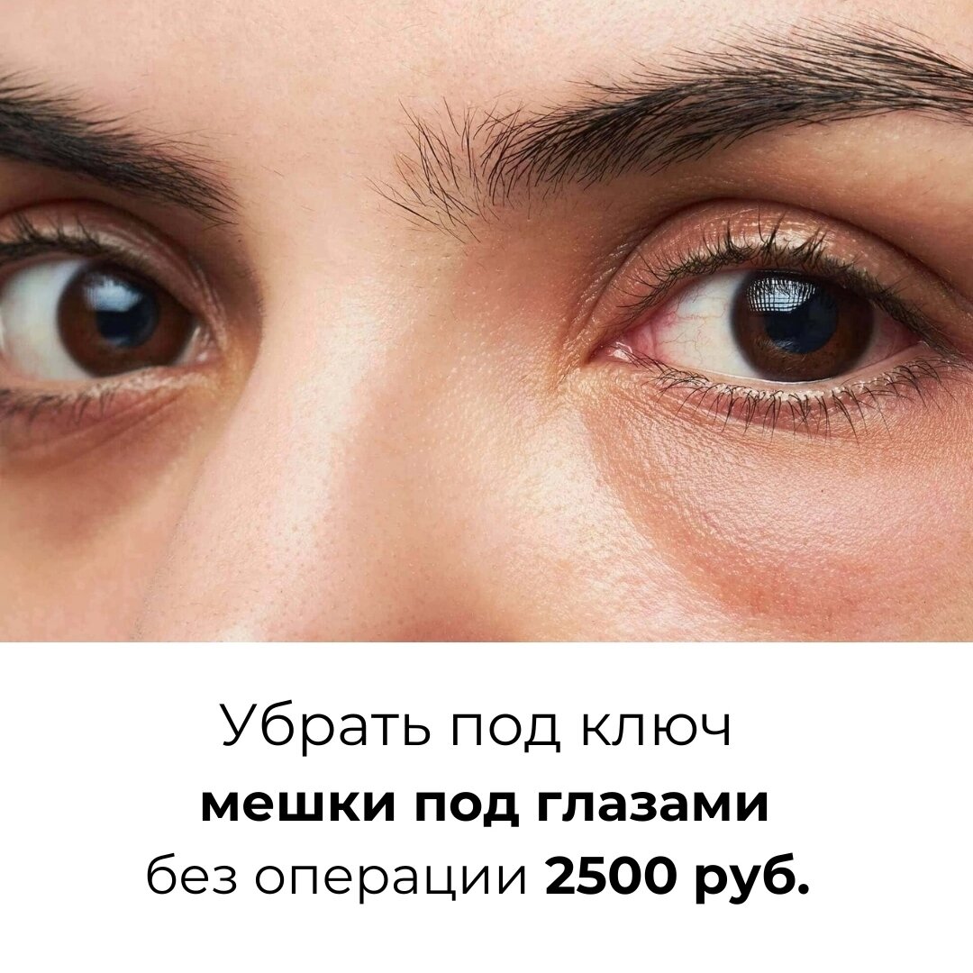 Идти куда глаза. Идти куда глаза
