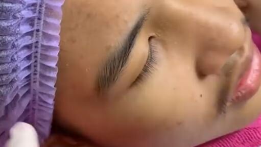 комбинированная чистка лица. косметолог 1 видео выдавливание. механическая чистка лица. чистка лица. механическая чистка.