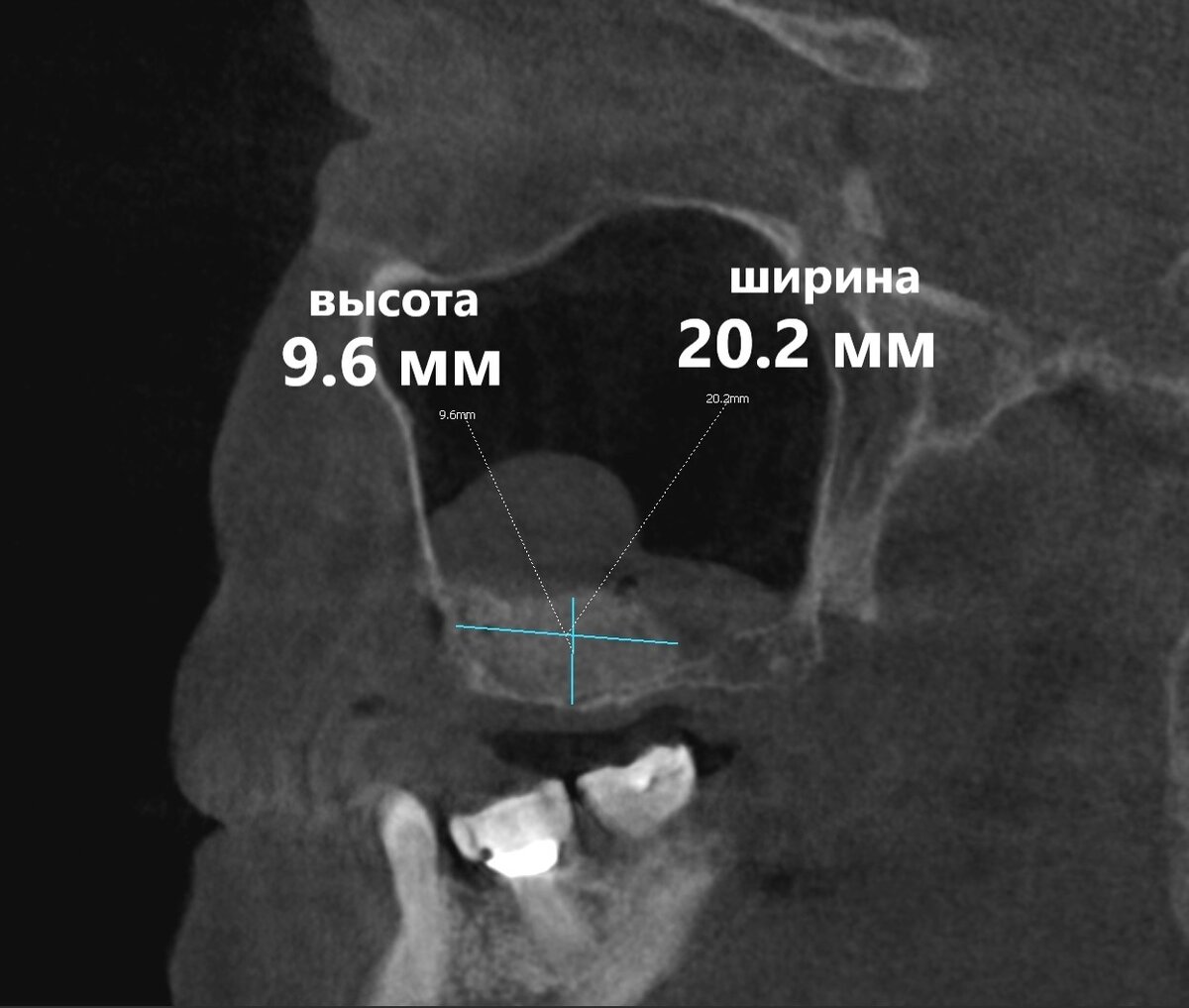 Как определить драпируемость ткани. Территория тканей. Площадь ткани. Площадь ткани. Красно синий квадратный.
