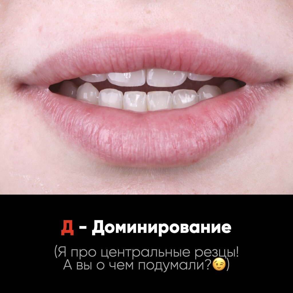 Красивые зубы. Виниры комплект snap-on smile. Виниры цельнокерамические emax. Виниры накладки. Виниры perfect smile veneers.