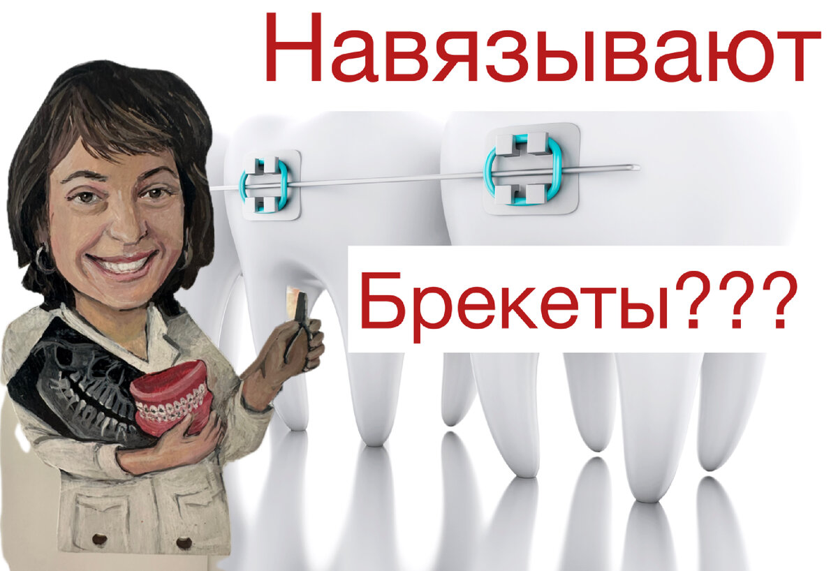 Почему вам «навязывают» брекеты? | Ортодонт Райтер | Брекеты ...