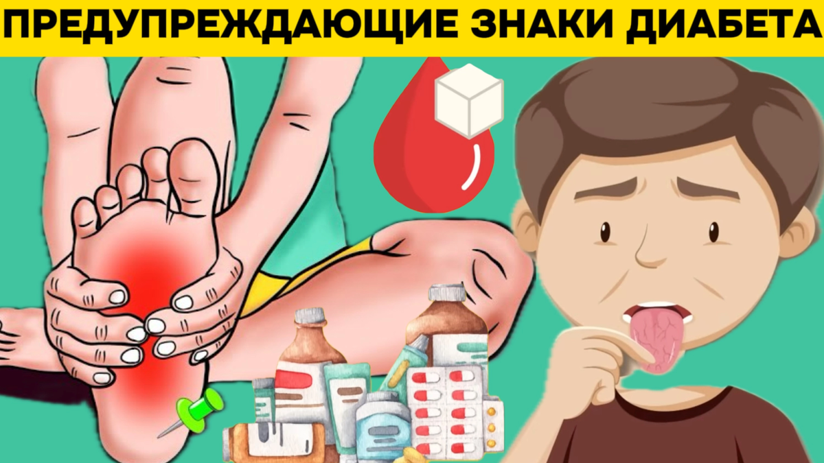 Места зуда при сахарном диабете. Мазь при сахарном диабете. Сахарный диабет симптомы. Сахарный диабет проявления на коже. Места зуда при сахарном диабете.