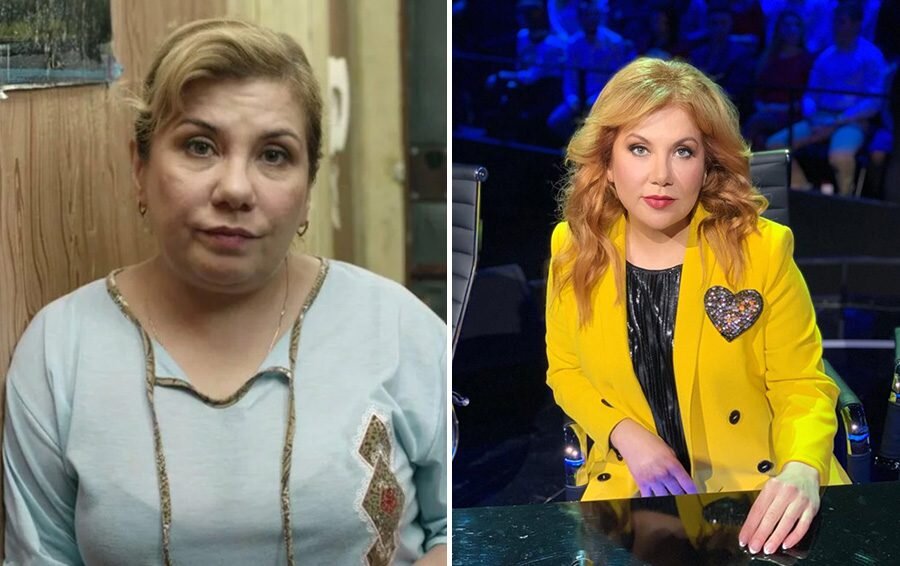 Федункив марина фото до и после пластики