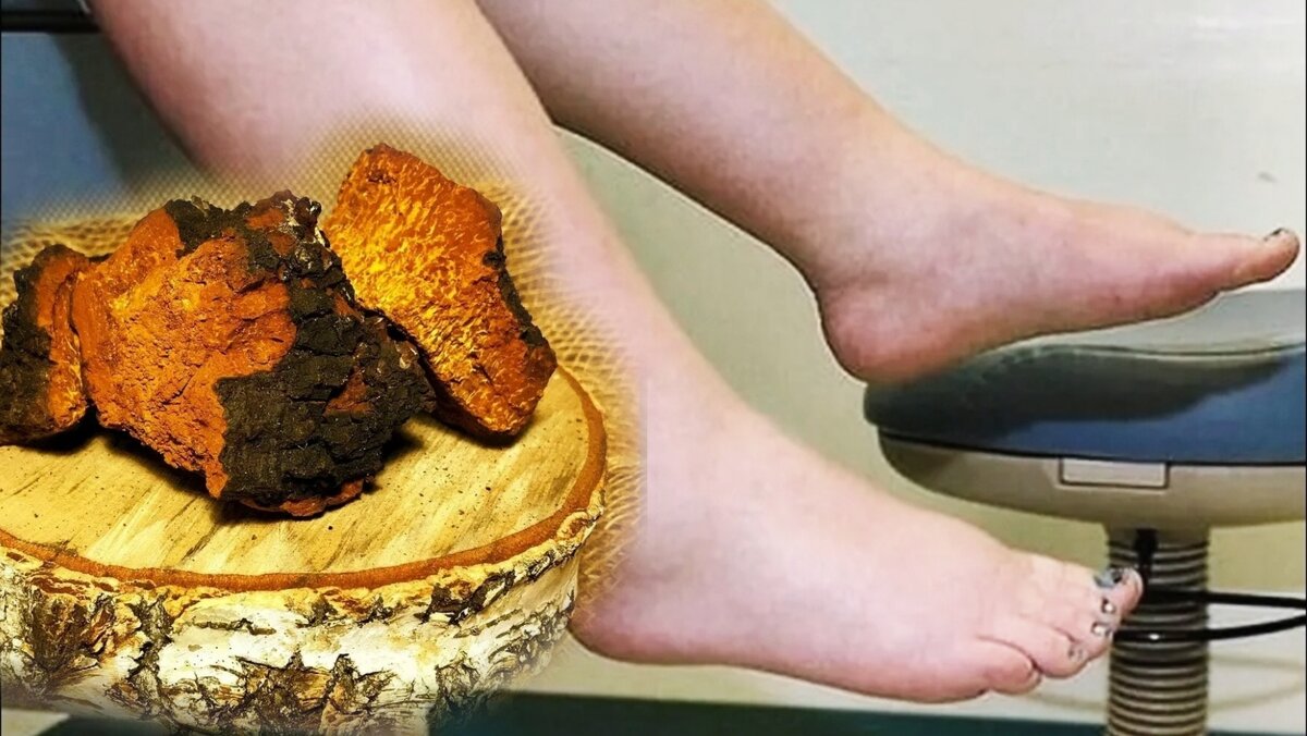 Очень хорошо уходят отеки и припухлости