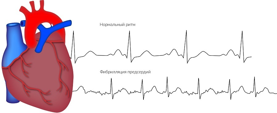 Можно ли по состоянию