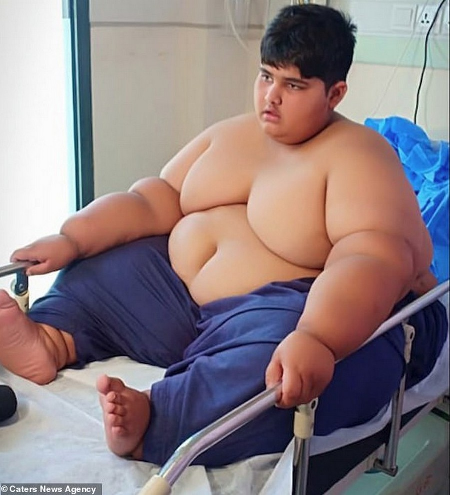 Ребенок 200 кг. Пакистанец Мохаммед арбрар.