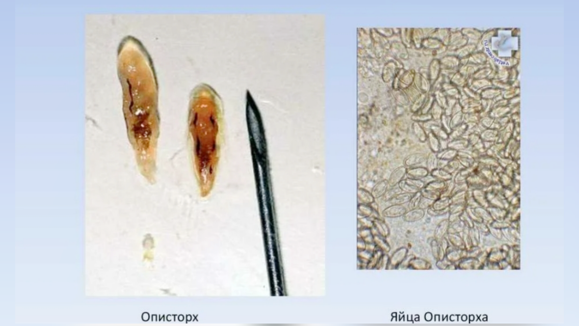 Описторх (кошачий сосальщик) и его личинки 