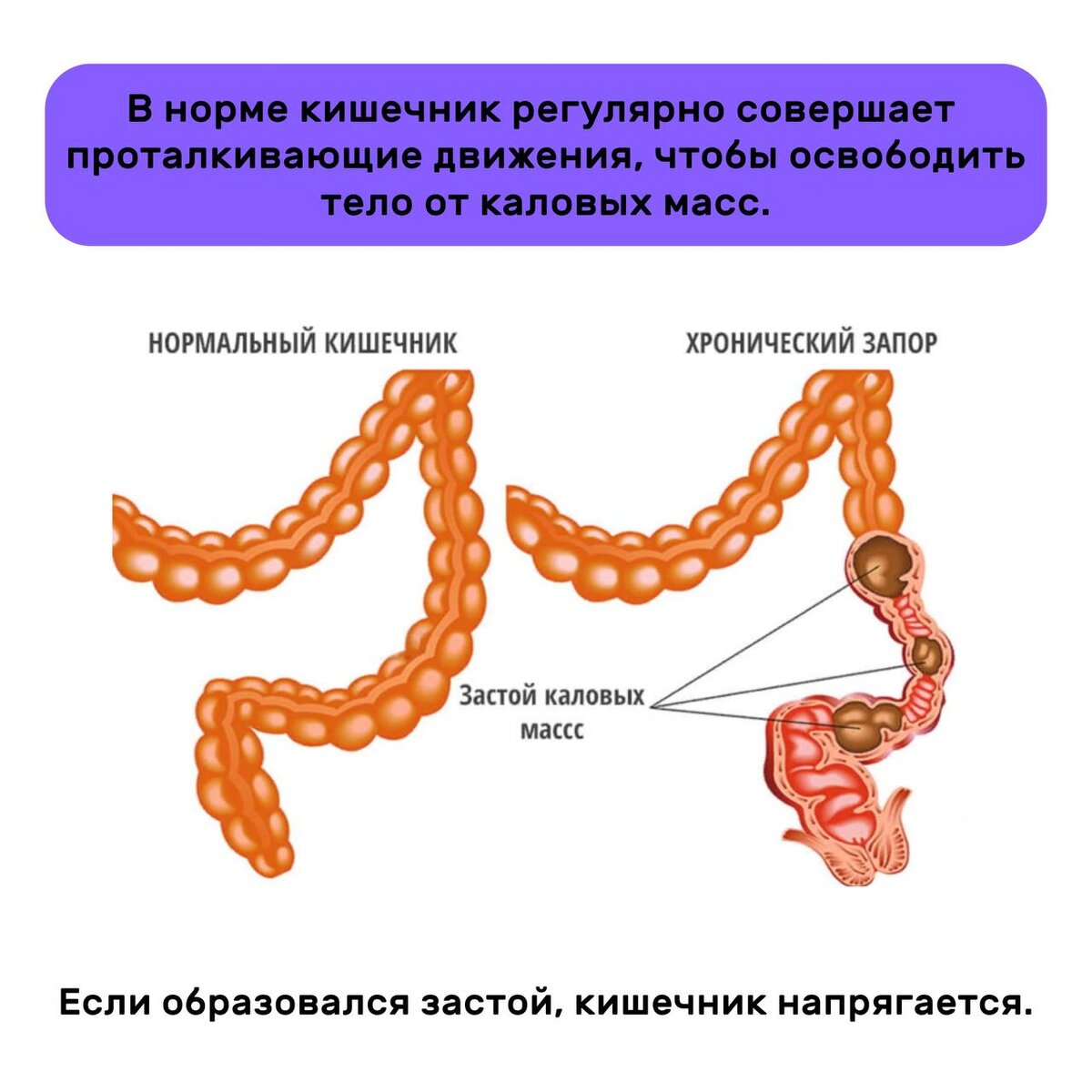 Болит кишечник и запор