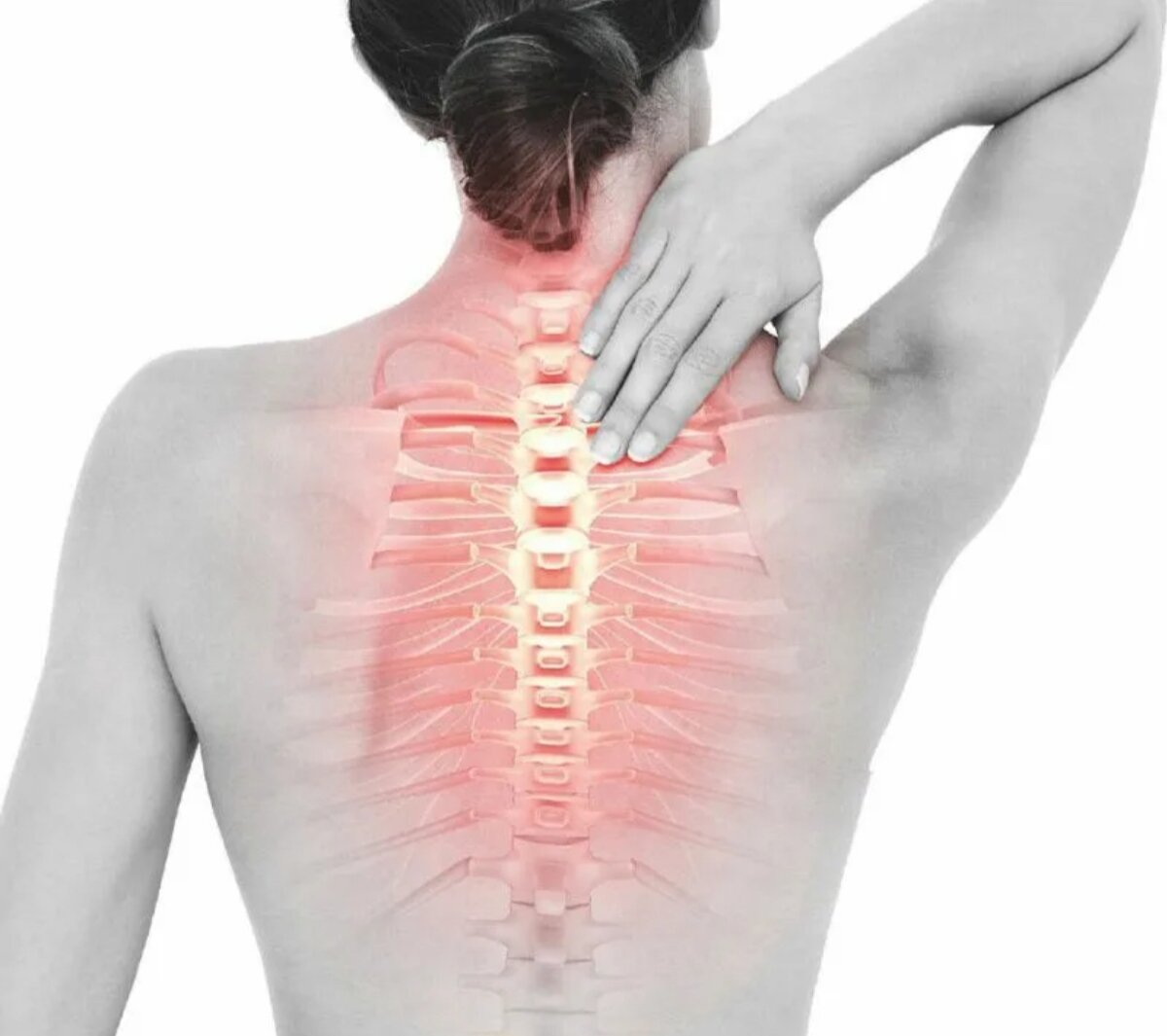 Гипертония при шейном остеохондрозе. Высокое давление шейный остеохондроз. Точки при остеохондрозе грудного отдела позвоночника. Шейно грудной остеохондроз давление. Шейно грудной остеохондроз давление.