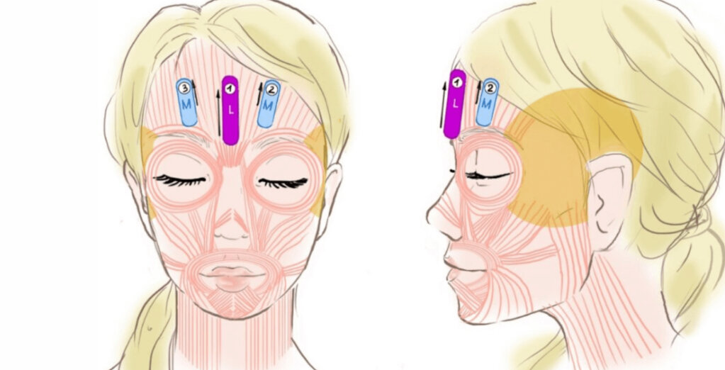 Схема 1. Фото из интернета.