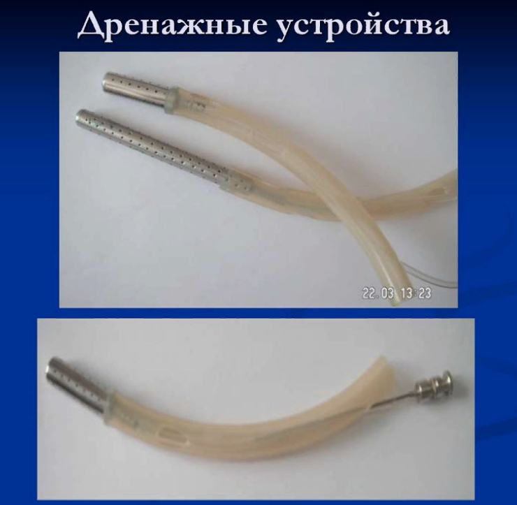 К какому методу антисептики дренирование относится. Пассивное дренирование. Физическая антисептика дренирование. Дренирование нитка