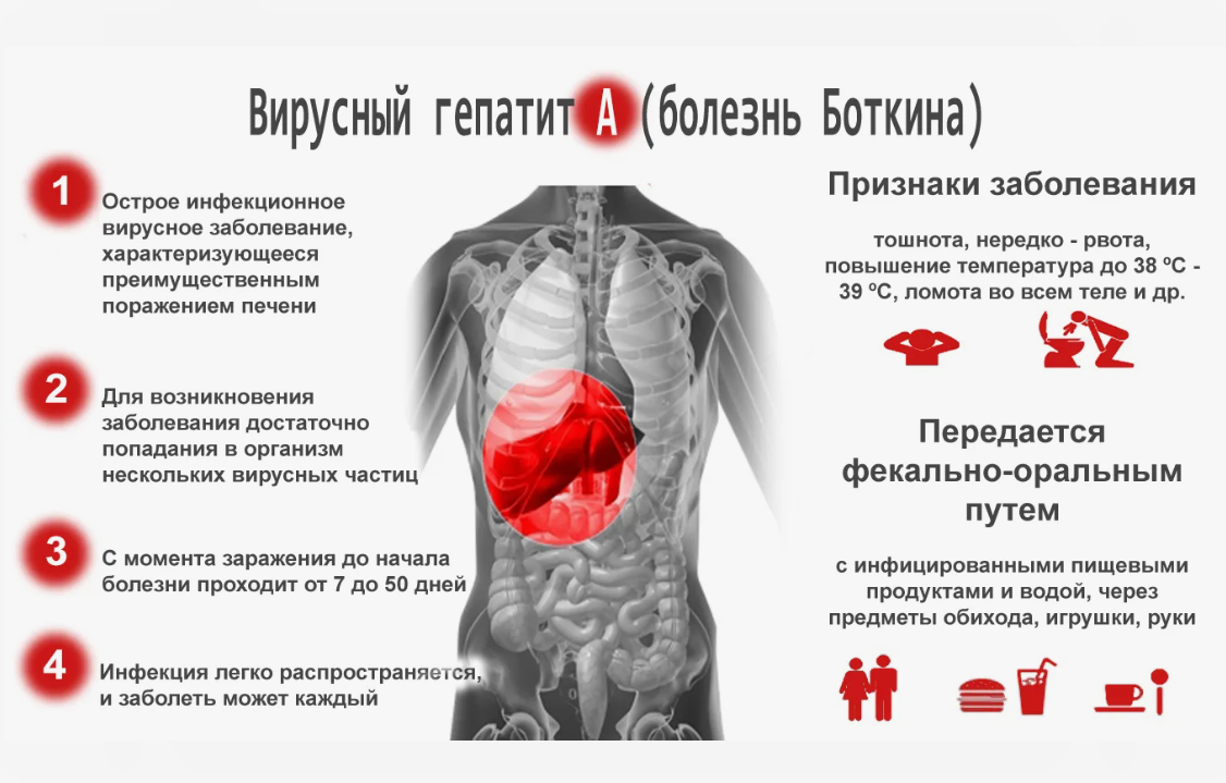 Болезнь Боткина – как лечат острый гепатит, сильно ли повреждается печень?  Отвечает врач | О здоровье: с медицинского на русский | Дзен