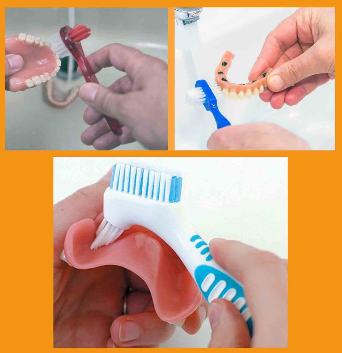 Съемный протез (6-14 зубов) термо джет. Несъемные протезы зубов. Съемный протез (6-14 зубов) термо джет. Съемный протез (3-5 зубов) термо джет. Частичный съемный пластиночный протез акриловый.