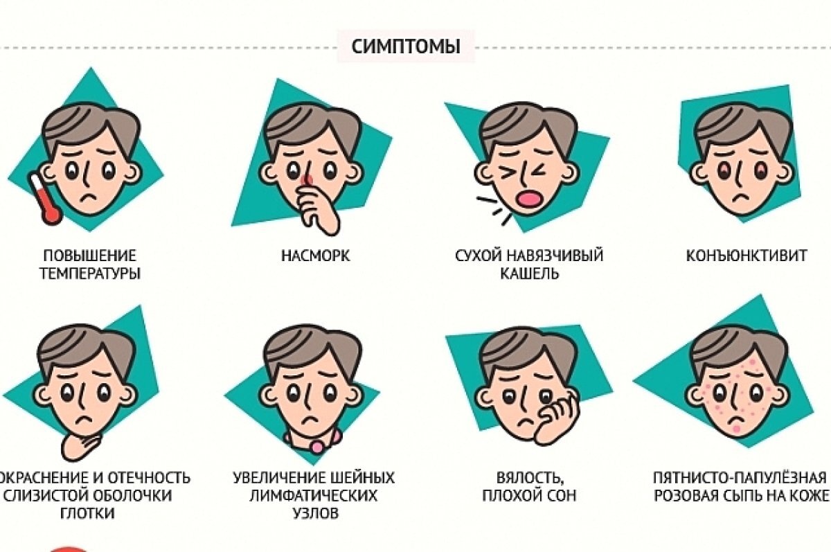 Корь симптомы и синдромы. Локализация кори